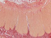 Desmosis coli x50
