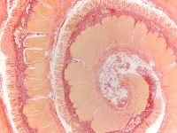 Desmosis coli x1 25